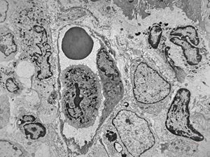 jejunum … celiakia … infiltration in lamina propria